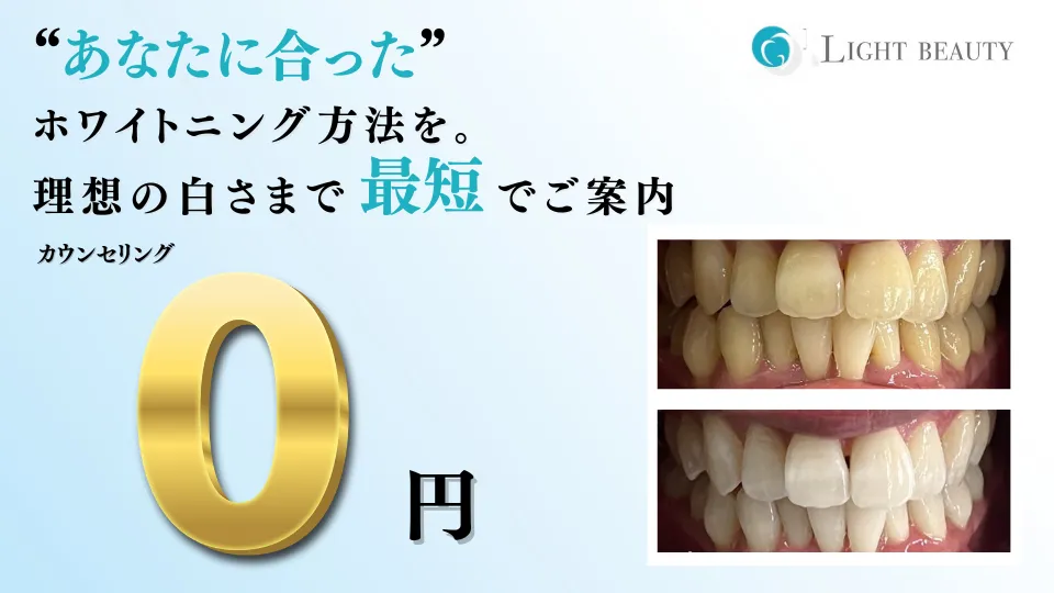 ホワイトニング専門店 ライトビューティー武蔵小杉店 | 歯科医連携の最